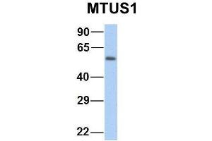 Host:  Rabbit  Target Name:  GNAS  Sample Type:  Human Fetal Heart  Antibody Dilution:  1. (MTUS1 antibody  (Middle Region))