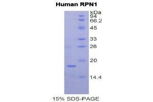 SDS-PAGE (SDS) image for Ribophorin 1 (RPN1) (AA 308-438) protein (His tag) (ABIN1877920) (RPN1 Protein (AA 308-438) (His tag))