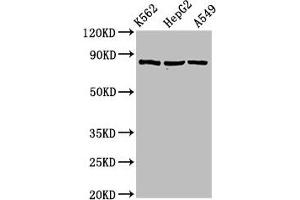 Western Blot Positive WB detected in: K562 whole cell lysate, HepG2 whole cell lysate, A549 whole cell lysate All lanes: HSP90AB1 antibody at 2 μg/mL Secondary Goat polyclonal to rabbit IgG at 1/50000 dilution Predicted band size: 84 kDa Observed band size: 84 kDa (HSP9AB1 (AA 150-355) antibody)