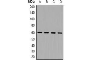 Western blot analysis of NOX1 expression in Hela (A), HEK293T (B), NIH3T3 (C), Mouse kidney (D) whole cell lysates.