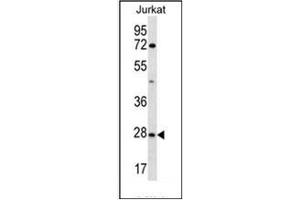 Western blot analysis of OR6T1 Antibody (C-term) in Jurkat cell line lysates (35ug/lane).