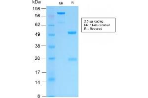 SDS-PAGE Analysis Purified Cytokeratin 16 Rabbit Recombinant Monoclonal Antibody (KRT16/2043R). (Recombinant KRT16 antibody  (C-Term))