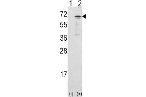 Western Blotting (WB) image for anti-Calcium/calmodulin-Dependent Protein Kinase Kinase 1, alpha (CAMKK1) antibody (ABIN3003480) (CAMKK1 antibody)