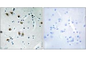 Immunohistochemistry analysis of paraffin-embedded human brain tissue, using ZNF148 Antibody. (ZNF148 antibody  (AA 61-110))
