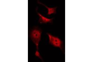ABIN6267480 staining SW626 by IF/ICC. (CTNNB1 antibody  (pTyr489))