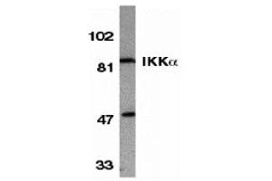 Western Blotting (WB) image for anti-conserved Helix-Loop-Helix Ubiquitous Kinase (CHUK) antibody (ABIN1030202) (IKK alpha antibody)