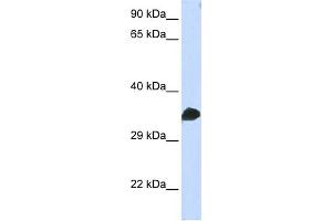 WB Suggested Anti-CDC2 Antibody Titration:  0. (CDK1 antibody  (N-Term))