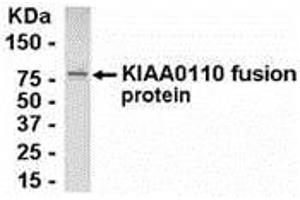 Western Blotting (WB) image for anti-MAD2L1 Binding Protein (MAD2L1BP) (AA 1-126) antibody (ABIN2468117) (MAD2L1BP antibody  (AA 1-126))