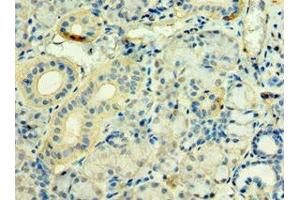 Immunohistochemistry of paraffin-embedded human pancreatic tissue using ABIN7171263 at dilution of 1:100 (STXBP3 antibody  (AA 343-592))