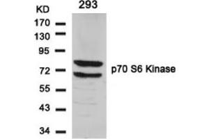 Image no. 3 for anti-Ribosomal Protein S6 Kinase, 70kDa, Polypeptide 1 (RPS6KB1) (Ser424) antibody (ABIN197548)