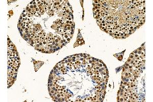 ABIN7095488 and ABIN7099545 at 1/100 staining mouse testis tissue by IHC-P. (UBXN7 antibody)