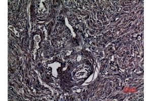 Immunohistochemistry (IHC) analysis of paraffin-embedded Human uterus, antibody was diluted at 1:100. (A1BG antibody  (Internal Region))