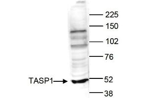 Western Blot of anti-TASP1 antibody Western Blot results of Rabbit anti-TASP1 antibody.