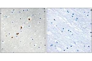 Immunohistochemistry analysis of paraffin-embedded human brain tissue, using ZNF596 Antibody.