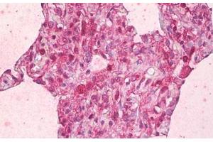 Anti-ABCB7 antibody IHC staining of human lung, alveoli.
