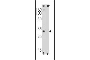 TSPY1 antibody  (C-Term)