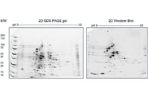2D SDS-PAGE: Load/Strip: 100 μg E. (Combined Host Cell Proteins antibody)