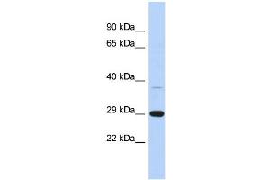 WB Suggested Anti-C1orf74 Antibody Titration: 0. (C1ORF74 antibody  (N-Term))