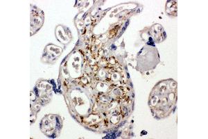 Anti-BAG5 antibody, IHC(P) IHC(P): Human Placenta Tissue (BAG5 antibody  (C-Term))