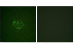 Immunofluorescence staining of methanol-fixed A549 cells using ACK1 (Phospho-Tyr284) Antibody. (TNK2 antibody  (pTyr284))
