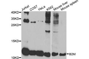Western blot analysis of extracts of various cell lines, using B2M antibody. (beta-2 Microglobulin antibody)