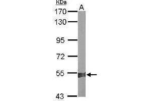 Western Blotting (WB) image for anti-Aldehyde Dehydrogenase 1 Family, Member A2 (ALDH1A2) antibody (ABIN2856988)