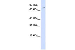 WB Suggested Anti-RIPK4 Antibody Titration:  0. (RIPK4 antibody  (Middle Region))