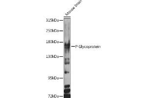 Western blot analysis of extracts of various cell lines, using P Glycoprotein antibody (ABIN6129943, ABIN6136341, ABIN6136344 and ABIN6216612) at 1:1000 dilution. (ABCB1 antibody  (AA 630-710))