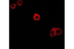 Immunofluorescent analysis of SPAM1 staining in Hela cells. (SPAM1 antibody)