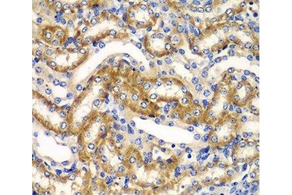 ZFAND3 antibody