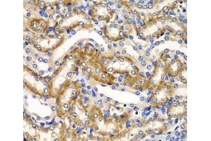 Immunohistochemistry of paraffin-embedded Mouse kidney using ZFAND3 Polyclonal Antibody at dilution of 1:100 (40x lens). (ZFAND3 antibody)