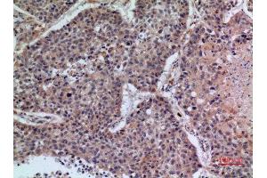 Immunohistochemistry (IHC) analysis of paraffin-embedded Human Lung, antibody was diluted at 1:100. (CD42b antibody  (Internal Region))