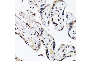 Immunohistochemistry of paraffin-embedded human placenta using A Rabbit pAb (ABIN6129868, ABIN6136479, ABIN6136480 and ABIN6221034) at dilution of 1:100 (40x lens). (BAF53A antibody  (AA 1-280))