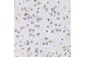 Immunohistochemistry of paraffin-embedded rat brain using IL13 antibody (ABIN5971115) (40x lens).