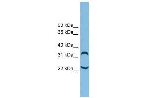 C6orf134 antibody used at 1 ug/ml to detect target protein. (Chromosome 6 Open Reading Frame 134 (C6orf134) (N-Term) antibody)