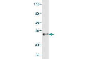 Western Blot detection against Immunogen (35. (MCPH1 antibody  (AA 399-487))