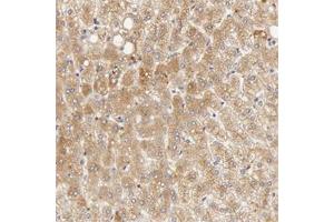 Immunohistochemical staining of human liver with TF polyclonal antibody  shows moderate cytoplasmic positivity in hepatocytes. (Transferrin antibody)