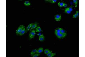 Immunofluorescence staining of HepG2 cells with ABIN7161148 at 1:125, counter-stained with DAPI. (Nephrin antibody  (AA 23-257))