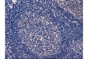 Image no. 3 for anti-Eukaryotic Translation Initiation Factor 4E Family Member 2 (EIF4E2) antibody (ABIN1497992) (EIF4E2 antibody)