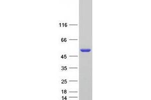Validation with Western Blot
