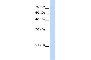 WB Suggested Anti-UNC93B1 Antibody Titration:  5. (UNC93B1 antibody  (N-Term))