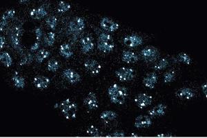 Immunofluorescence staining of A431 cells (Human epithelial carcinoma, ATCC CRL-1555). (NPAT antibody  (AA 681-803))
