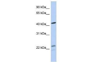 BCKDHA antibody used at 1 ug/ml to detect target protein. (BCKDHA antibody  (N-Term))