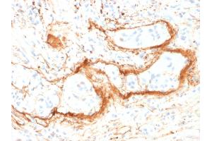 Formalin-fixed, paraffin-embedded human Small Intestine stained with Monospecific Mouse Monoclonal Antibody (ELN/1981) to Elastin. (Elastin antibody)