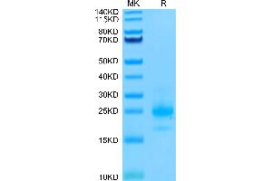TNFRSF10A Protein (His-Avi Tag,Biotin)