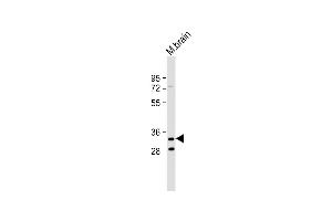 Anti-TMEM106B Antibody (C-Term) at 1:2000 dilution + Mouse brain lysate Lysates/proteins at 20 μg per lane. (TMEM106B antibody  (AA 218-252))