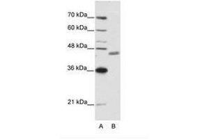Image no. 1 for anti-Zinc Finger Protein 396 (ZNF396) (N-Term) antibody (ABIN6736192) (ZNF396 antibody  (N-Term))