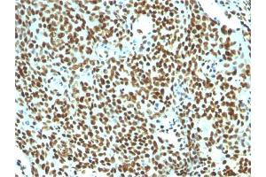 Formalin-fixed, paraffin-embedded human Tonsil stained with Pan-Nuclear Antigen Monoclonal Antibody (NM106). (Nuclear Antigen (Pan-Nuclear Marker) antibody)