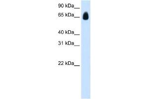 Western Blot showing TRIM32 antibody used at a concentration of 1. (TRIM32 antibody  (C-Term))