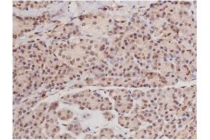 ABIN6269133 at 1/200 staining Human pancreas tissue sections by IHC-P. (KIT antibody  (Internal Region))